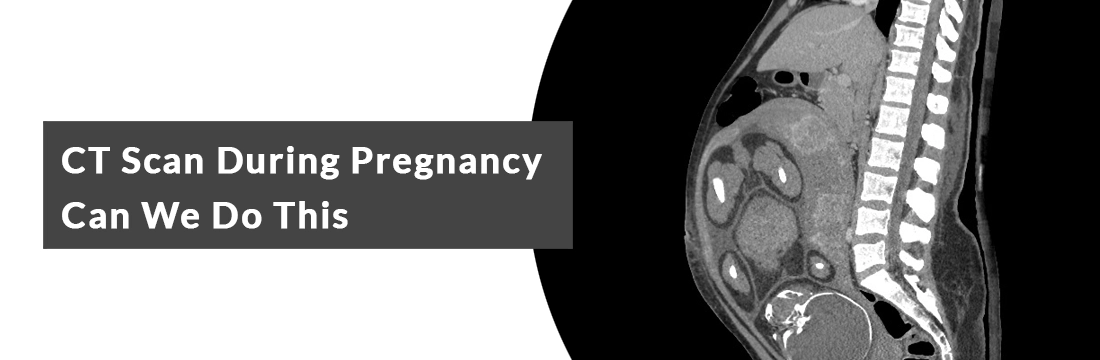 CT Scan During Pregnancy: Can We Do This